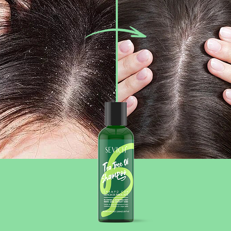 Çay Ağacı Özü Şampuan Saç Krem - Hair Care Conditioner incelemesi ve fiyatı