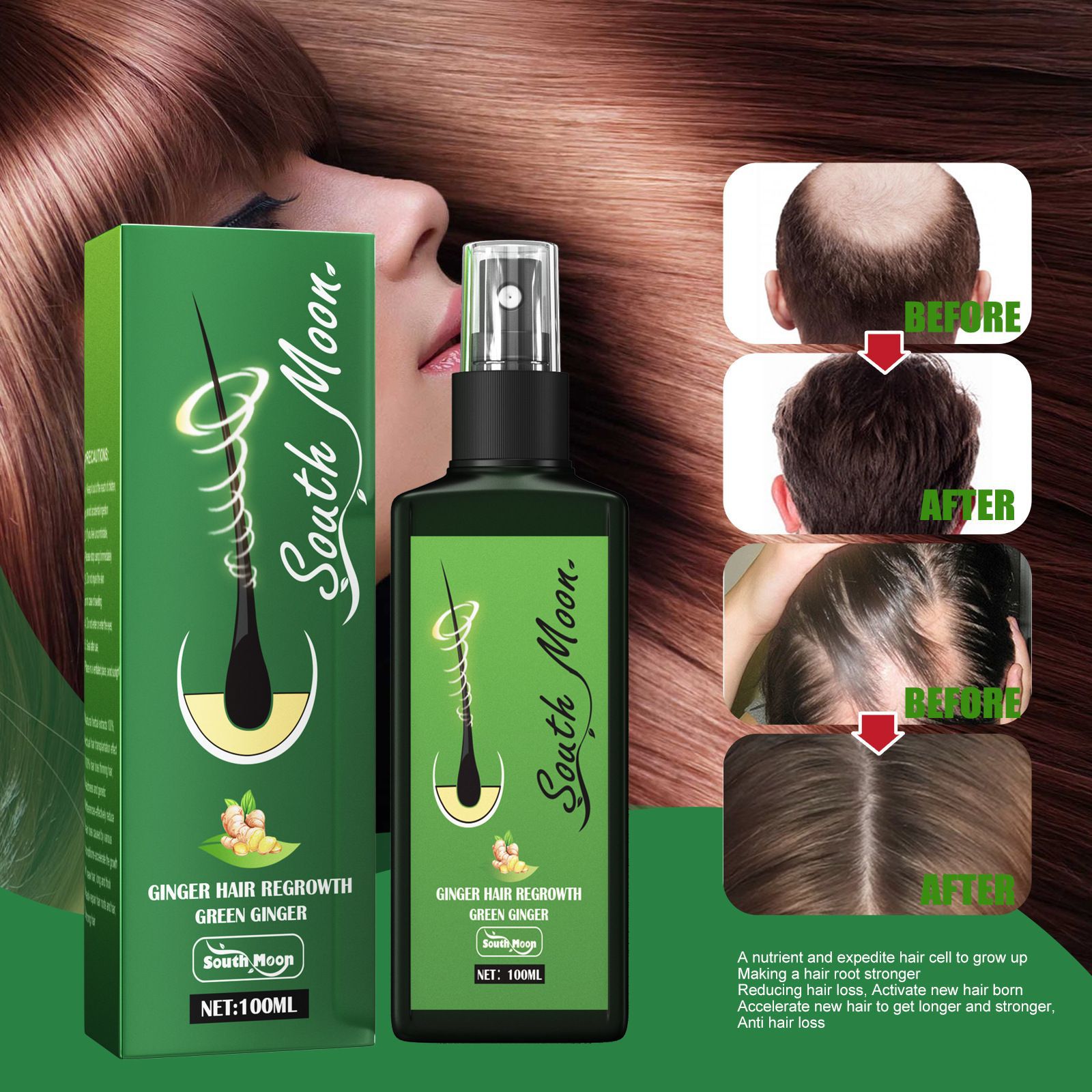 South Moon Zencefil Saç Uzatma - Hair Care Elseve incelemesi ve fiyatı