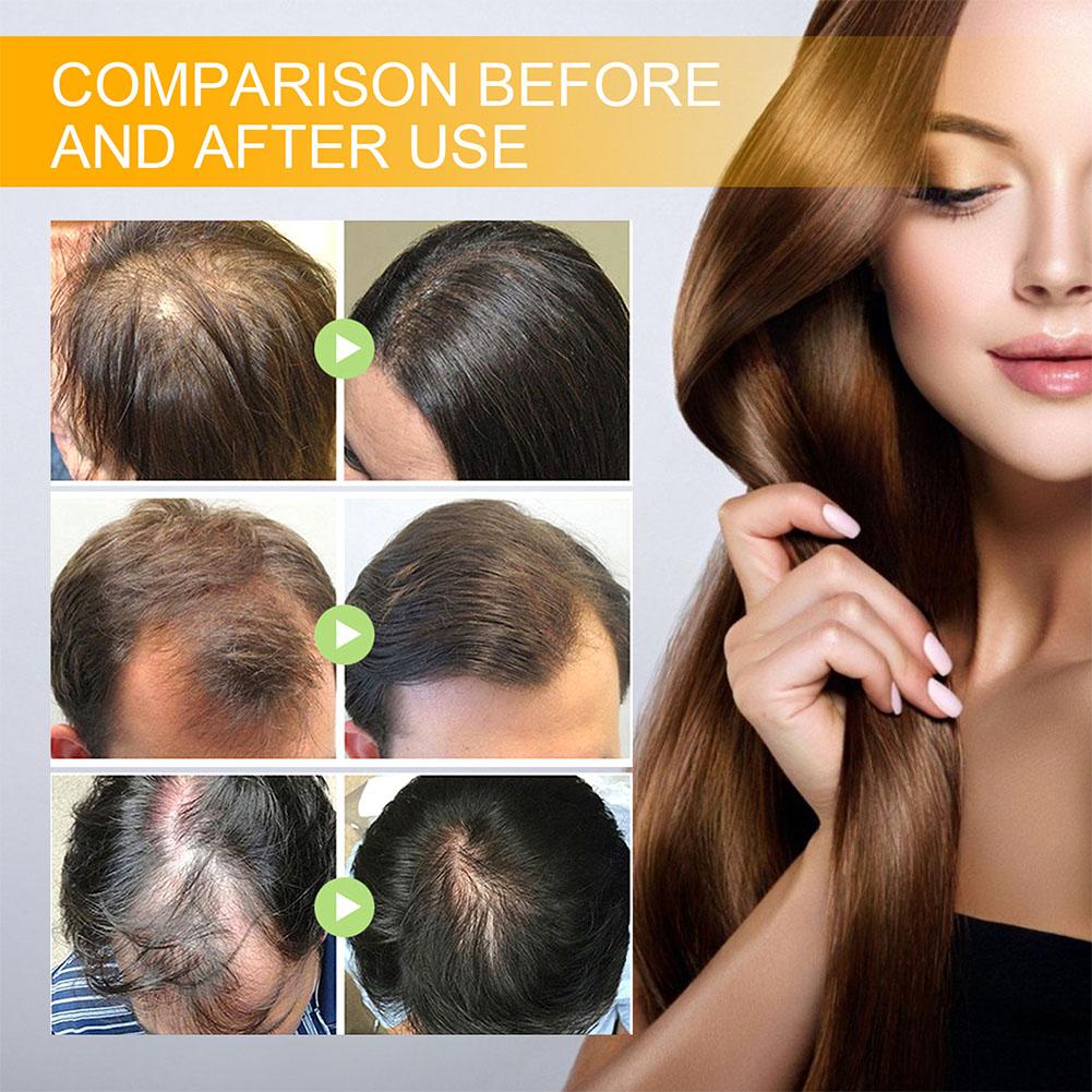 5/3/1 adet Biotin Hızlı Saç Bü - Hair Care Elseve incelemesi ve fiyatı